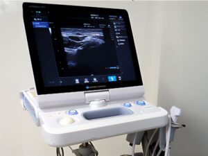超音波診断装置